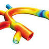 Fluid-structure Interaction & CFD